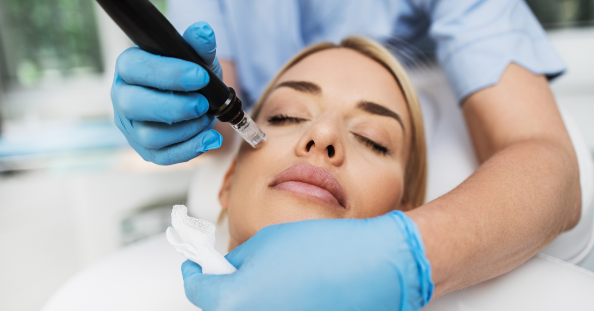 Microneedling with PRP in Woodlands, TX