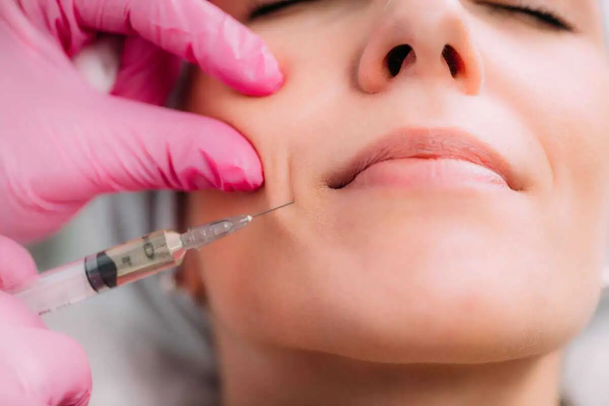 Dermal Fillers treatment at Flawless Aesthetics