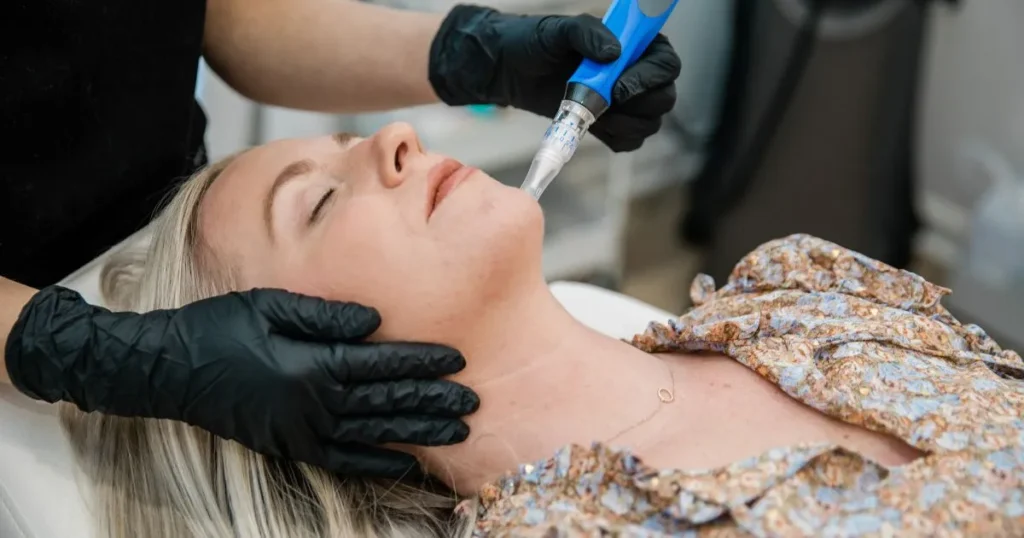 A blonde woman receiving a SkinPen microneedling treatment in Woodlands, TX
